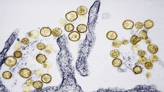 Hanta_Virus
